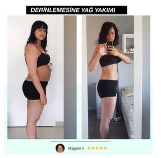 VibraKeyf: Profesyonel Vücut Şekillendirici & Selülit Giderici - 2